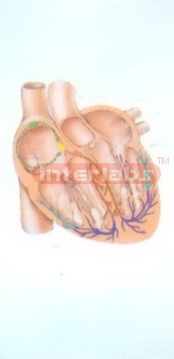 HANGING HUMAN CONDUCTING BYPASS OF THE HEART